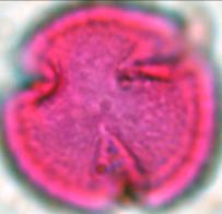 xalapensis